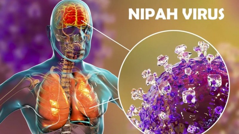 Azərbaycanda "Nipah"a yoluxma qeydə alınmayıb - RƏSMİ