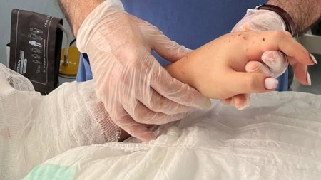 Bakıda 29 yaşlı qadının qopmuş qolu bərpa olundu 